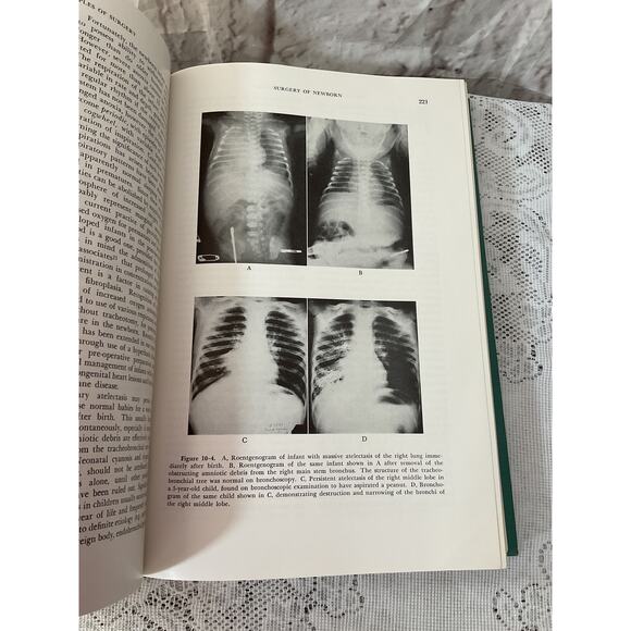 1965 2nd Ed Physiologic Principles of Surgery by Leo Zimmerman Rachmiel Levine - Picture 7 of 10